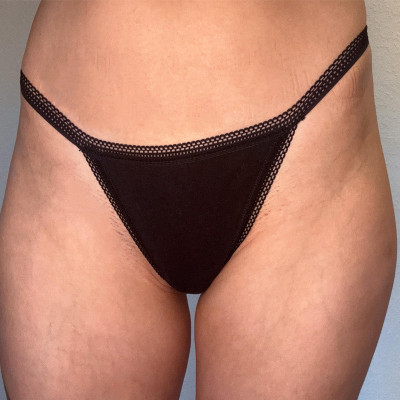 Black Thong - Nora Devot